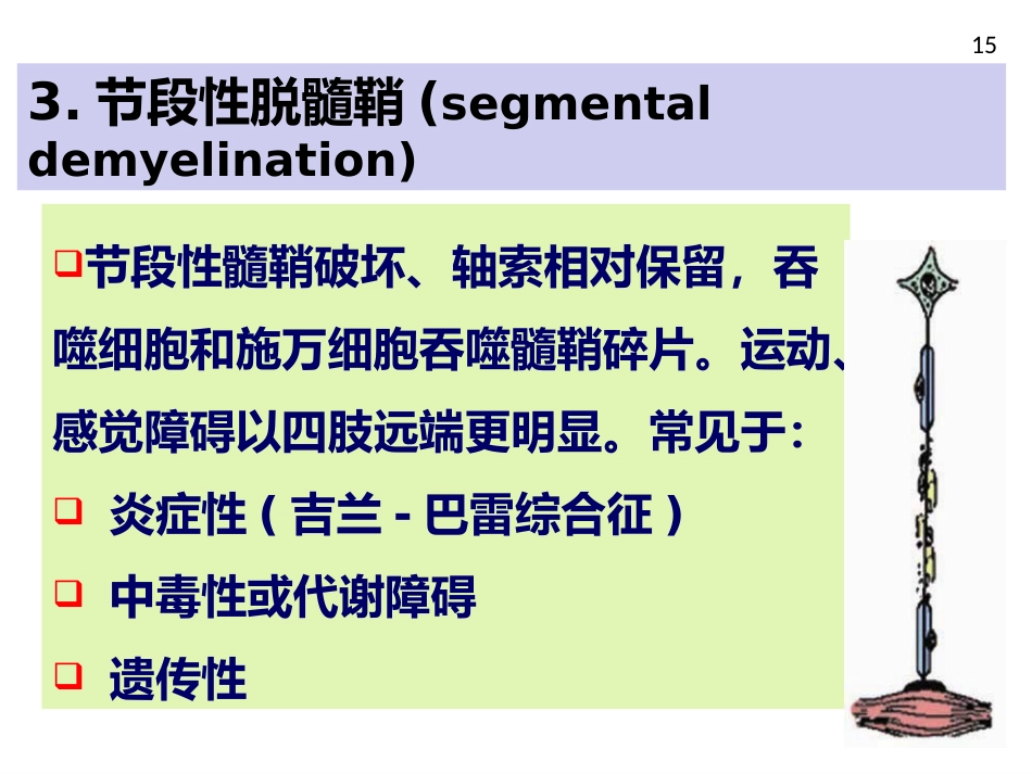 周围神经病_第15页