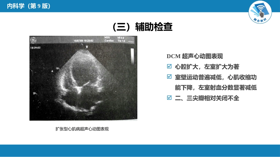 心内科：心肌疾病_第12页