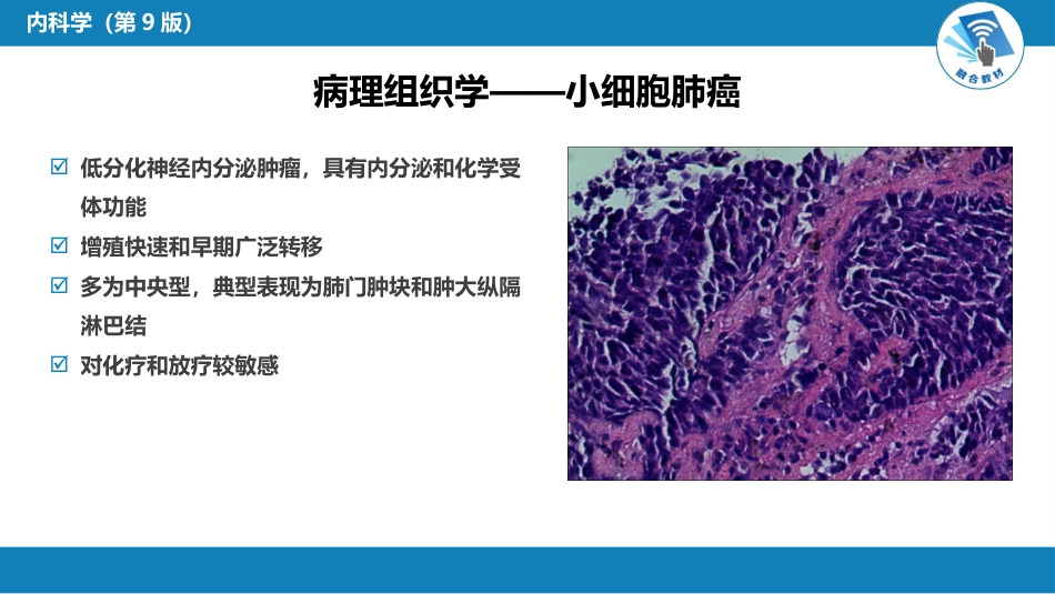 呼吸系统疾病：肺癌_第11页