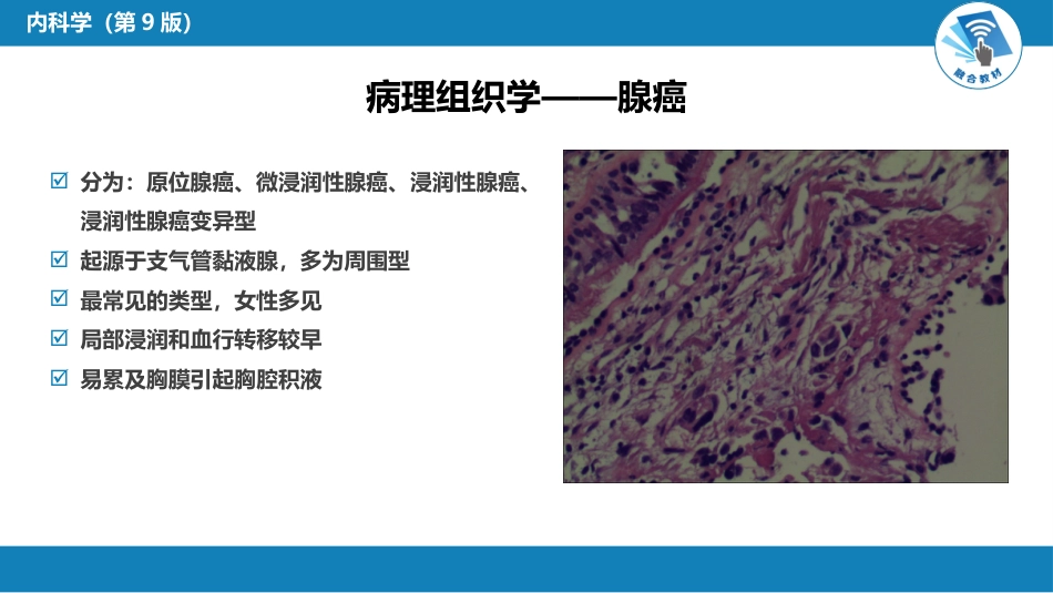 呼吸系统疾病：肺癌_第9页