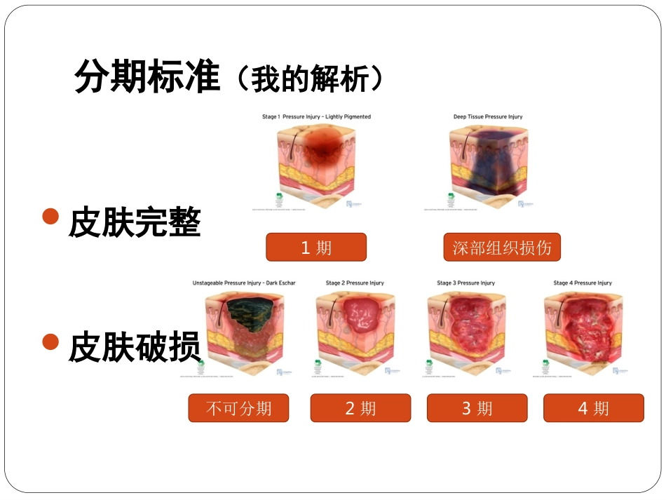 压疮_第3页