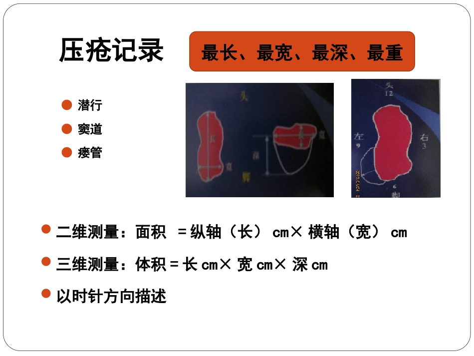 压疮_第9页