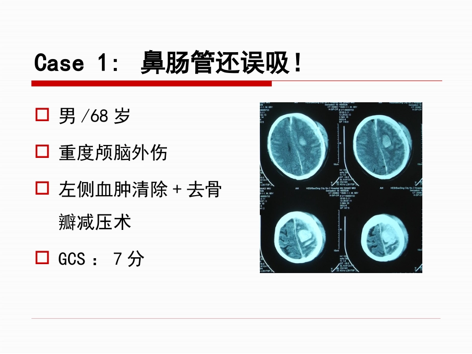 神经重症患者康复期肠内营养途径选择_第10页