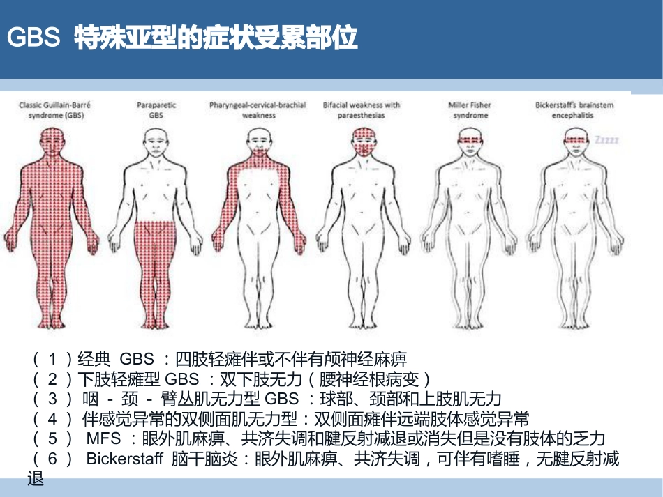 吉兰-巴雷综合征分型与诊断_第11页