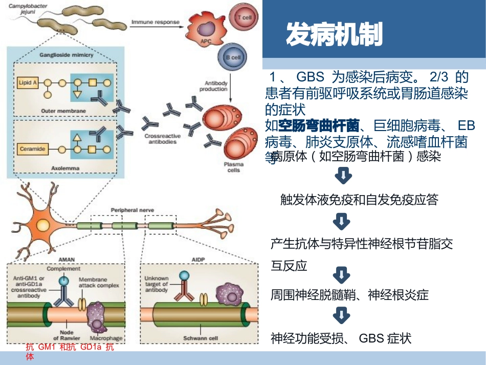 吉兰-巴雷综合征分型与诊断_第3页