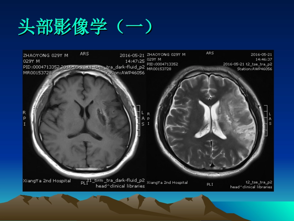 反常栓塞_第3页