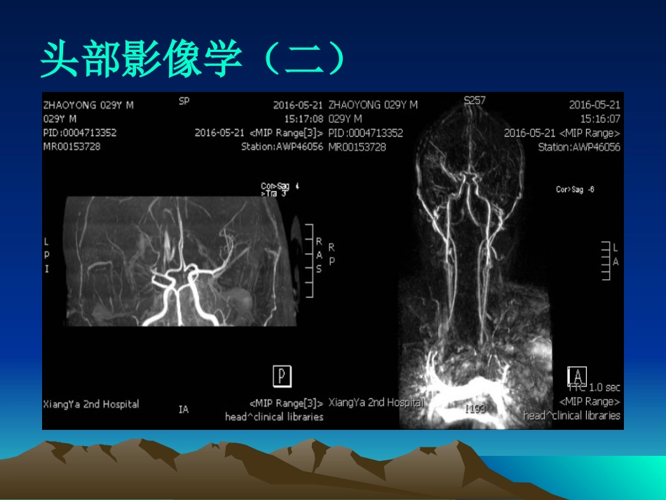 反常栓塞_第4页