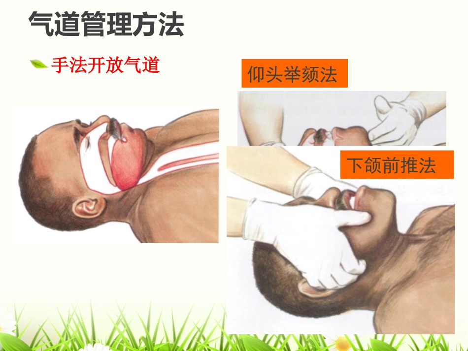 危重患者的气道管_第9页