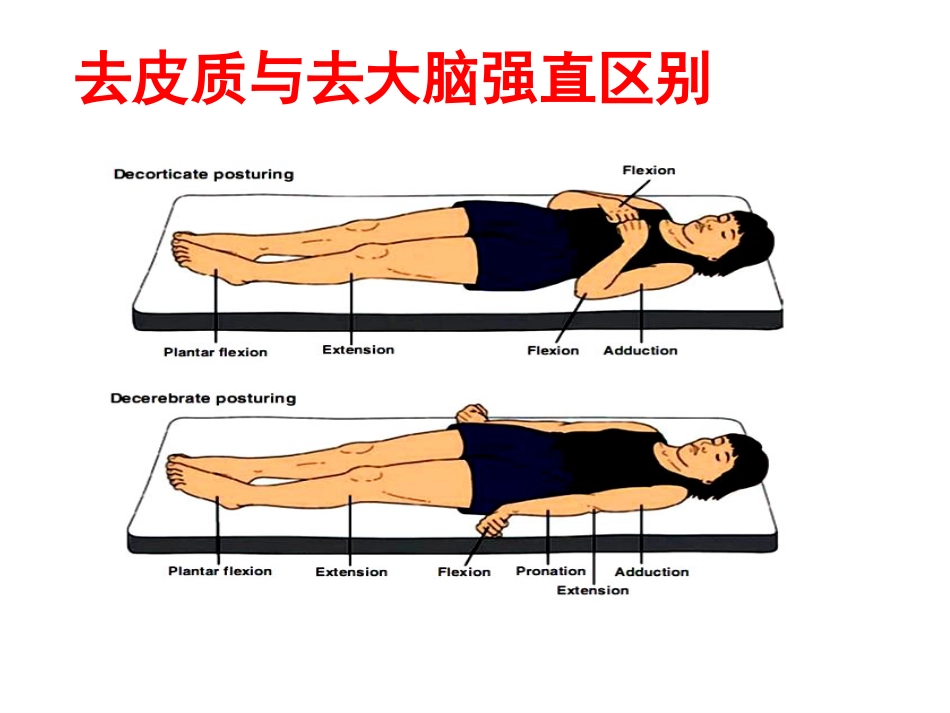 意识障碍课件_第15页
