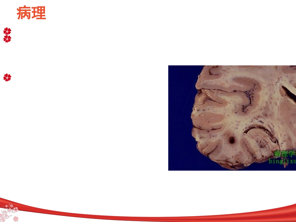 中枢神经系统感染_第10页