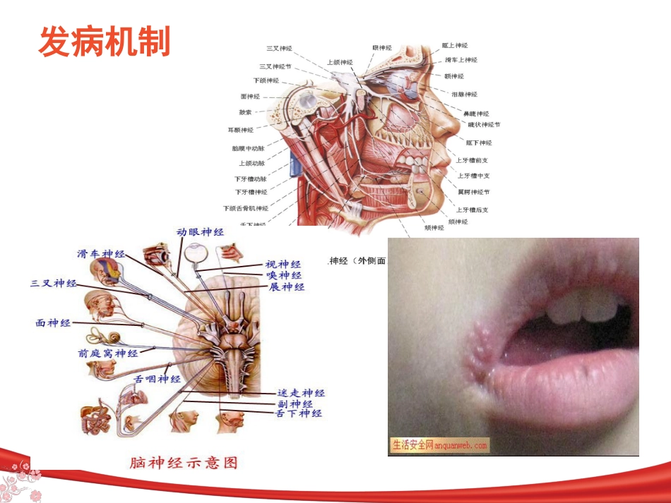 中枢神经系统感染_第8页