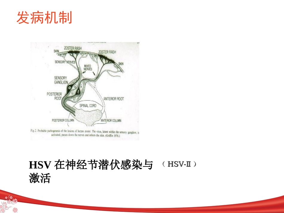 中枢神经系统感染_第9页