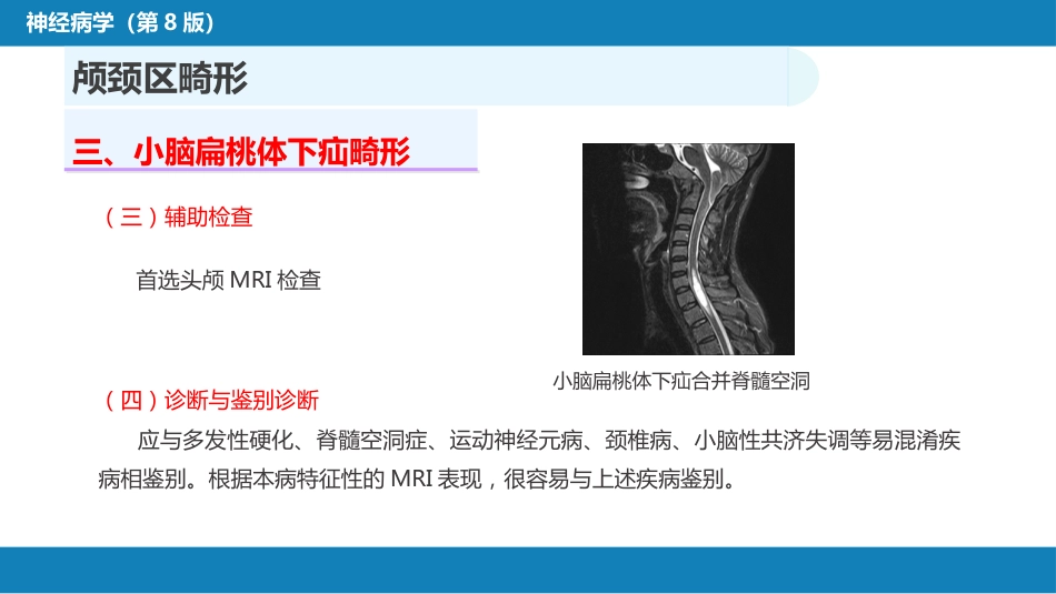 第二十一章 神经系统发育异常性疾病_第13页