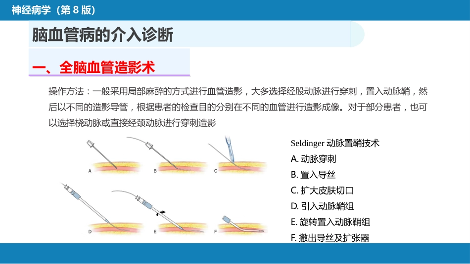 第十章 脑血管病的介入诊疗（1）_第6页
