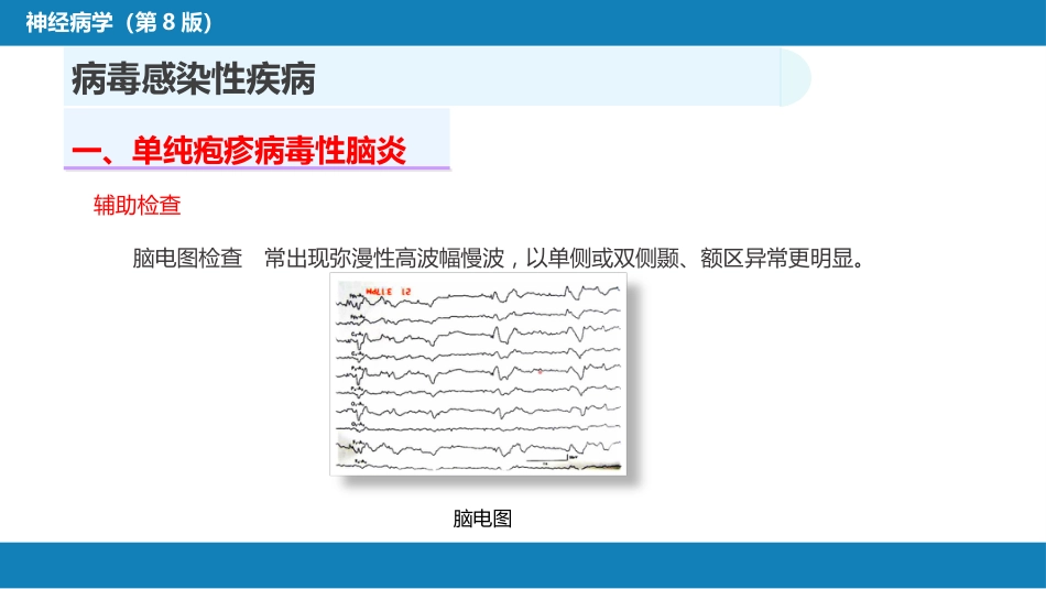 第十二章 中枢神经系统感染性疾病（1）_第11页