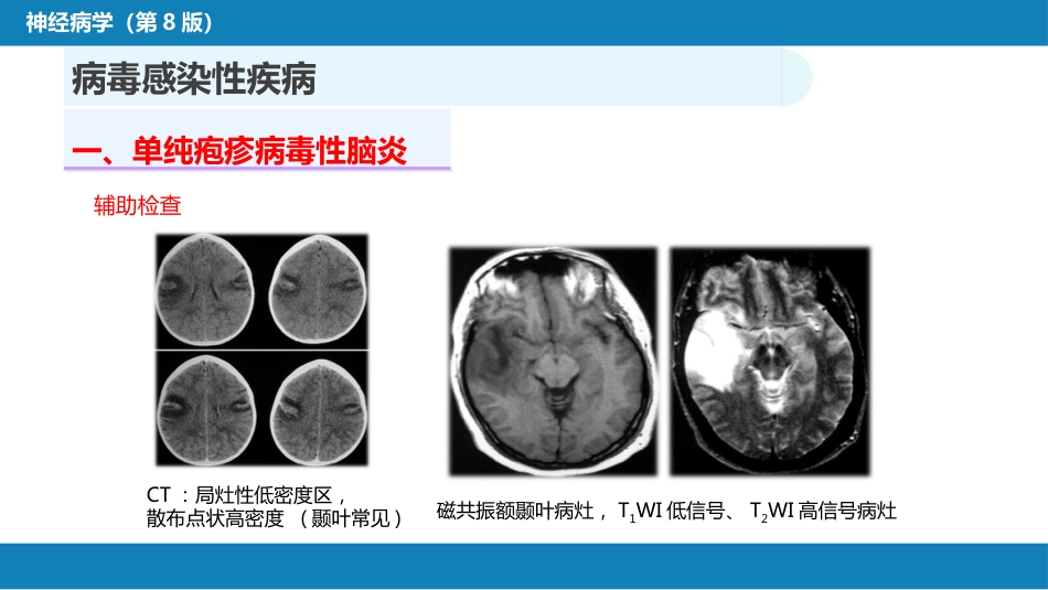 第十二章 中枢神经系统感染性疾病（1）_第12页