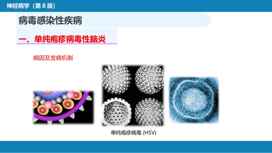 第十二章 中枢神经系统感染性疾病（1）_第6页