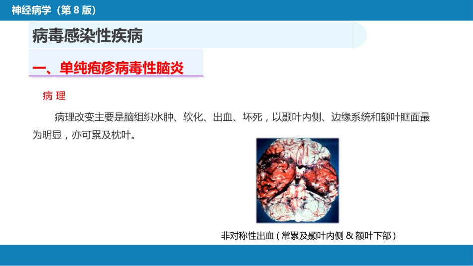 第十二章 中枢神经系统感染性疾病（1）_第8页