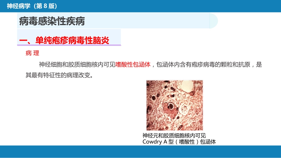 第十二章 中枢神经系统感染性疾病（1）_第9页