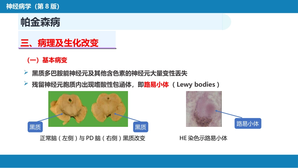 第十四章 运动障碍性疾病（1）_第10页