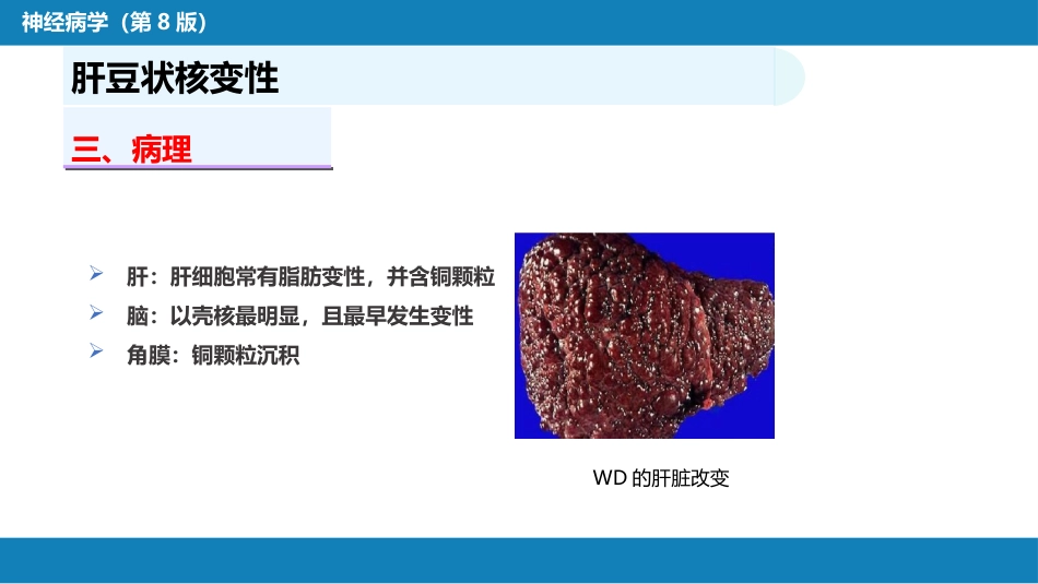 第十四章 运动障碍性疾病（2）_第5页
