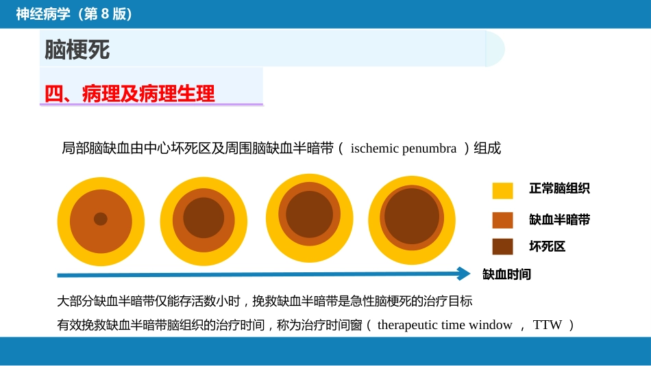 第九章 脑血管疾病（2）_第6页
