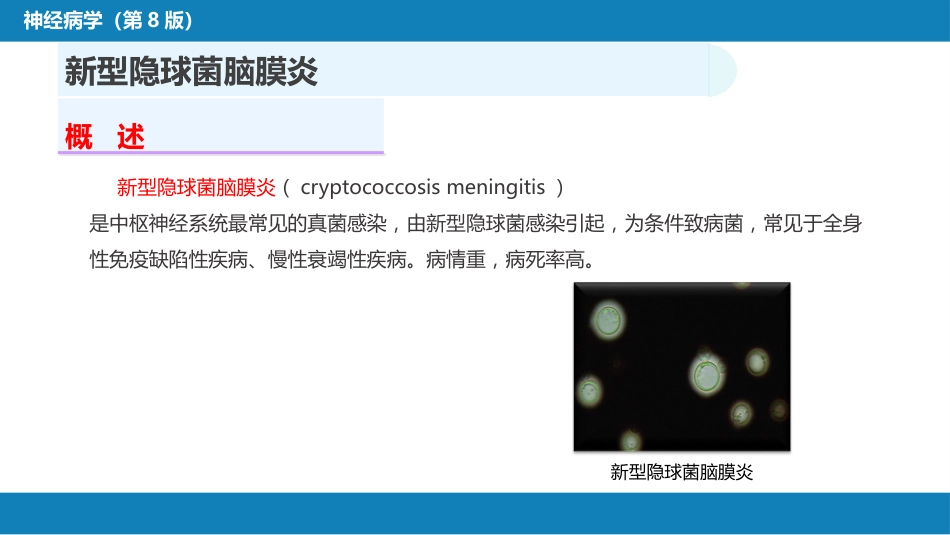 第十二章 中枢神经系统感染性疾病（2）_第4页