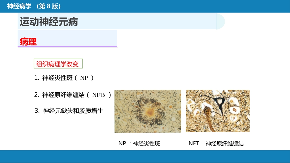 第十一章 神经系统变性疾病（2）_第9页