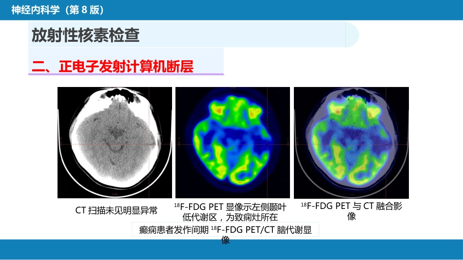 第五章 神经系统疾病的辅助检查（3）_第5页