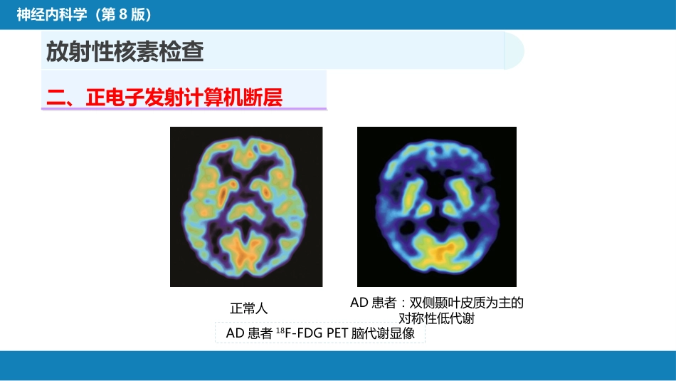 第五章 神经系统疾病的辅助检查（3）_第6页