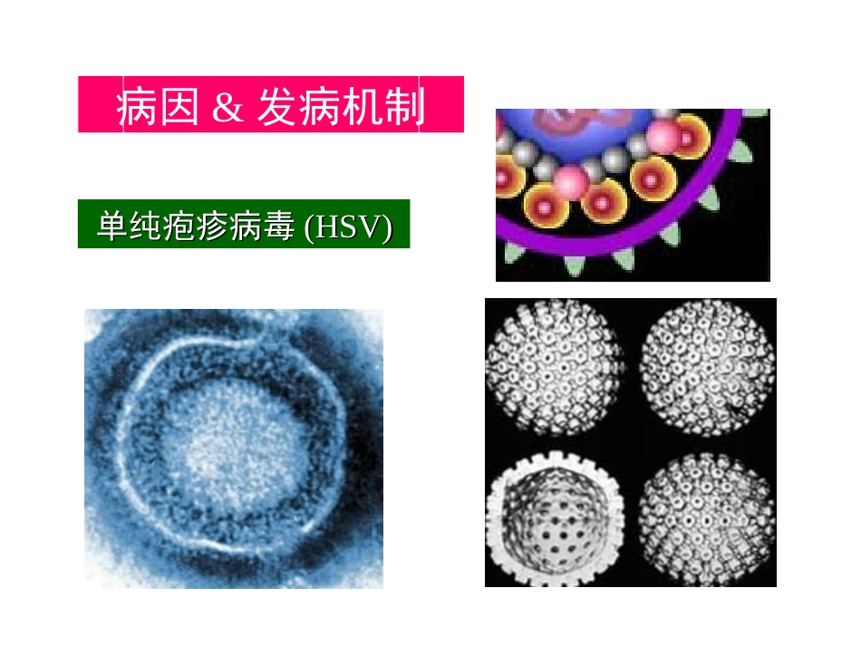 中枢神经系统感染 (3)_第10页