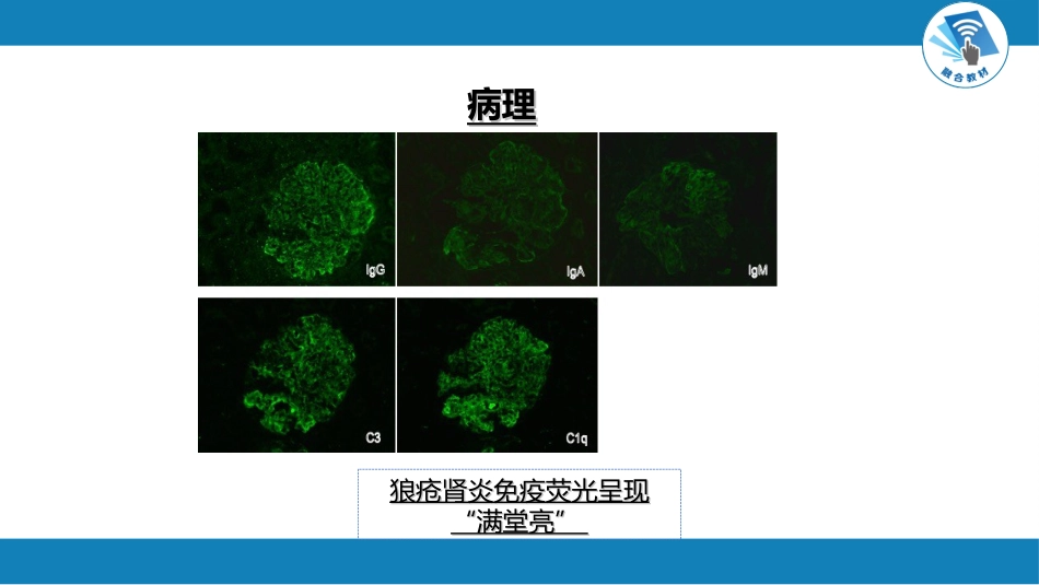 肾内科：继发性肾病_第6页