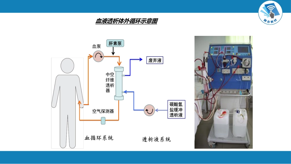 肾内科：肾脏替代治疗_第6页