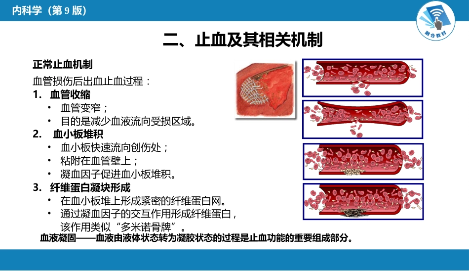 血液科：出血性疾病概述_第5页