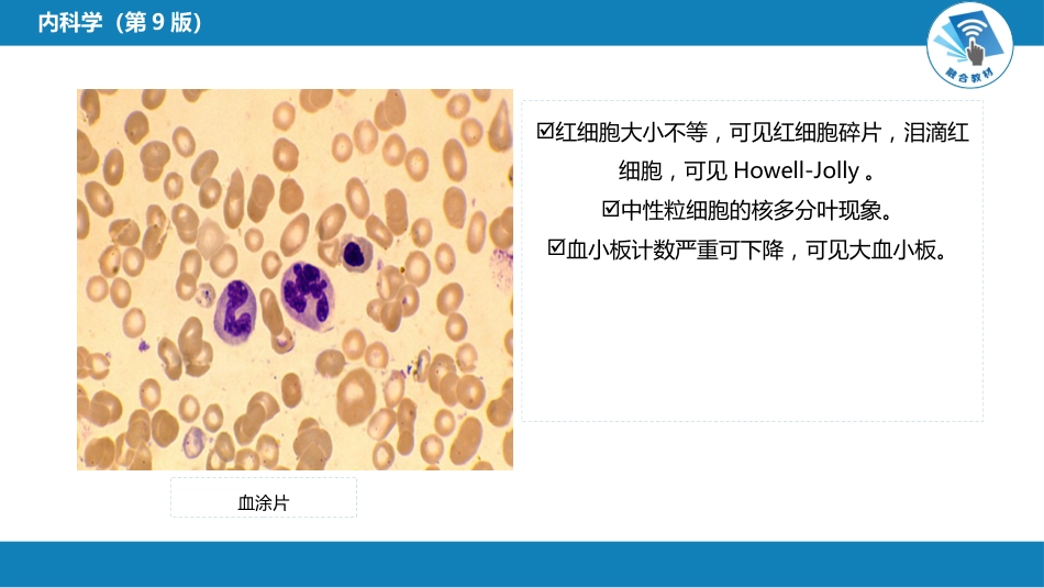 血液科：巨幼细胞贫血_第8页