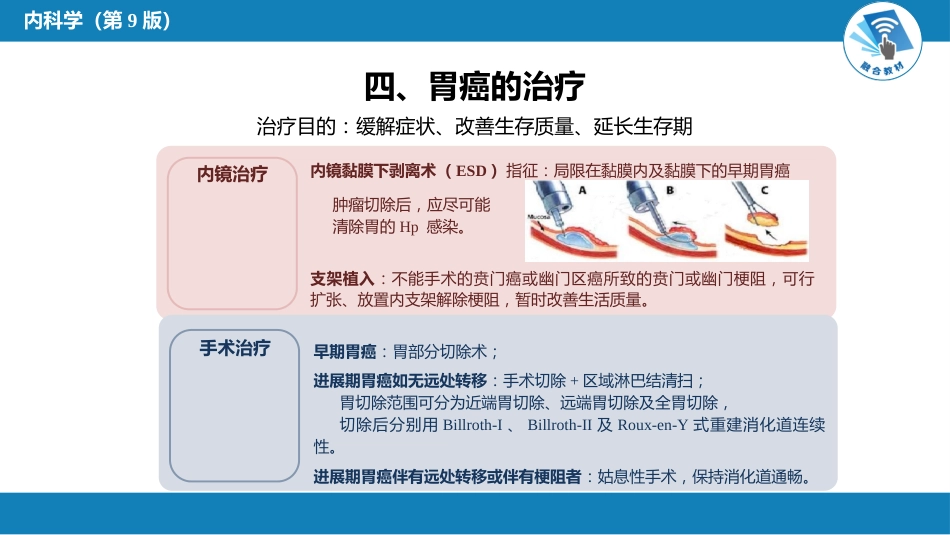 消化内科：胃癌_第6页