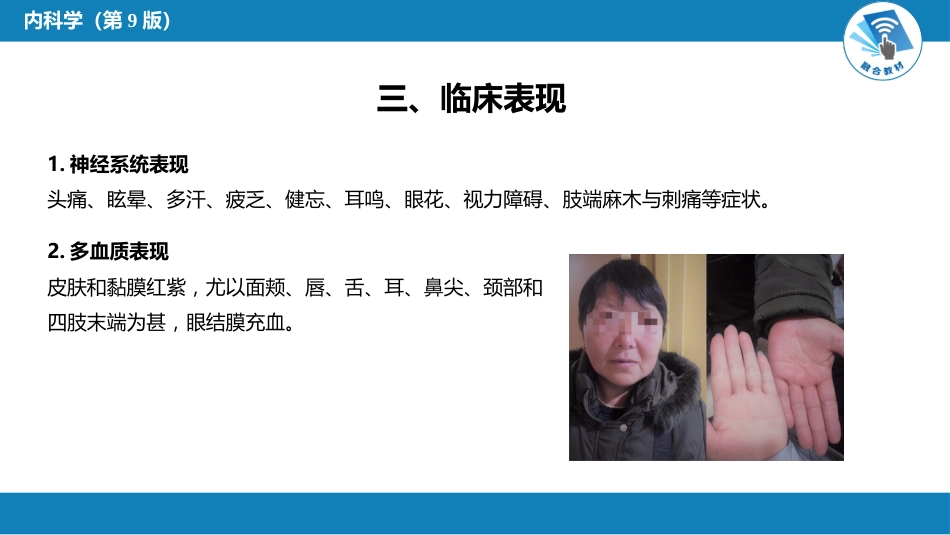 血液科：骨髓增殖性肿瘤_第6页