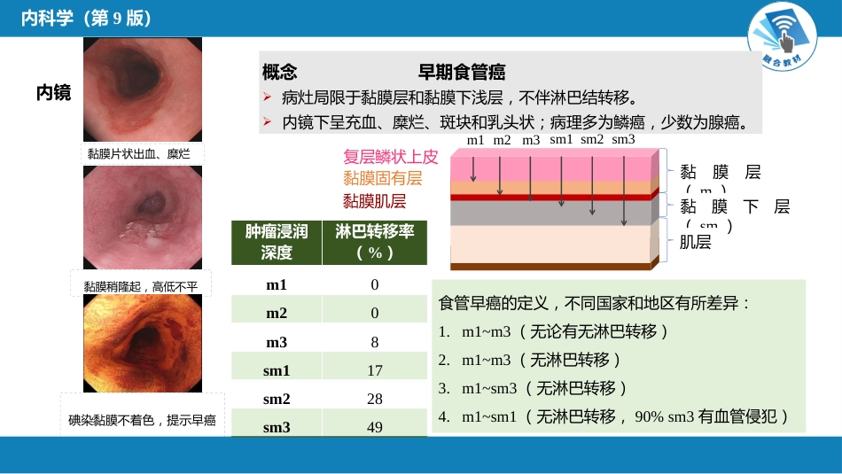 消化内科：食管癌_第4页