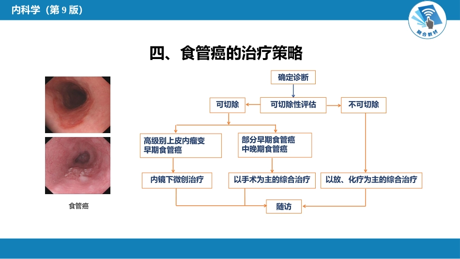 消化内科：食管癌_第7页