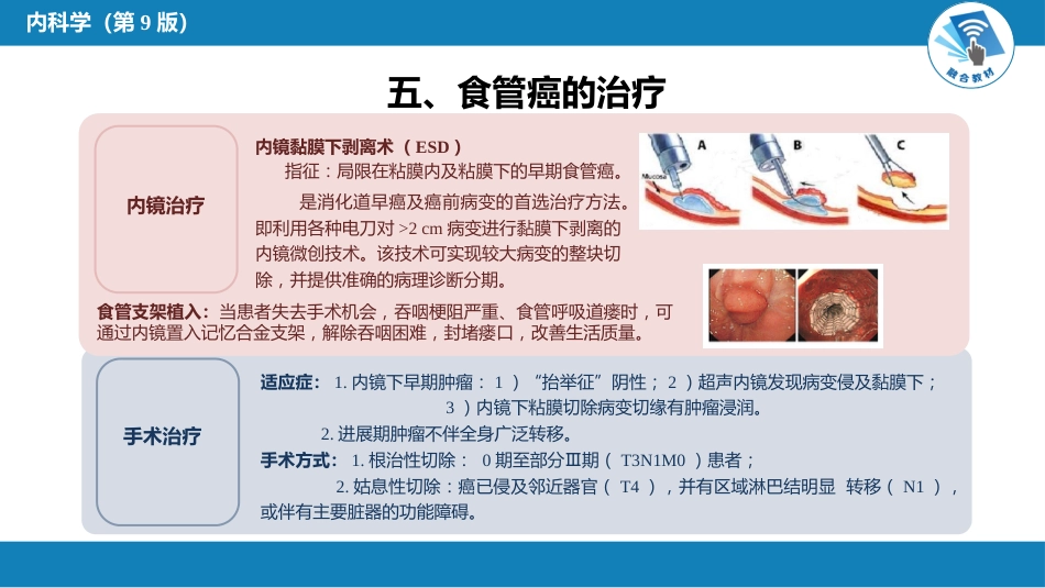 消化内科：食管癌_第8页