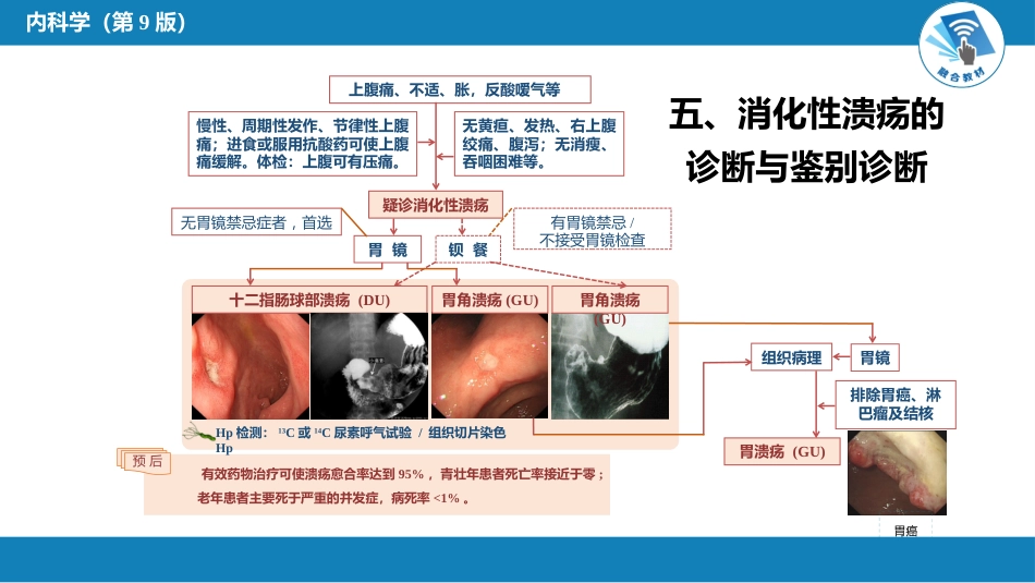 消化内科：消化性溃疡_第7页