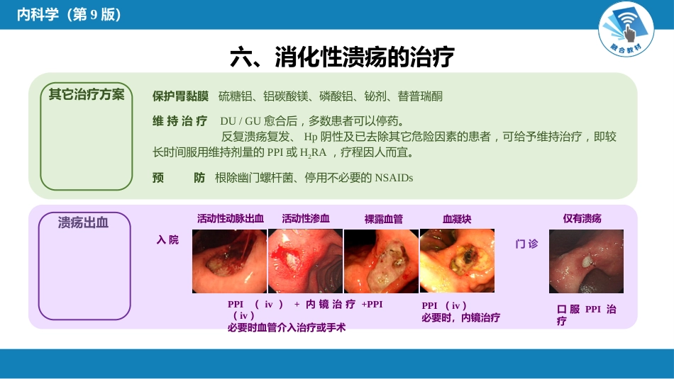 消化内科：消化性溃疡_第9页