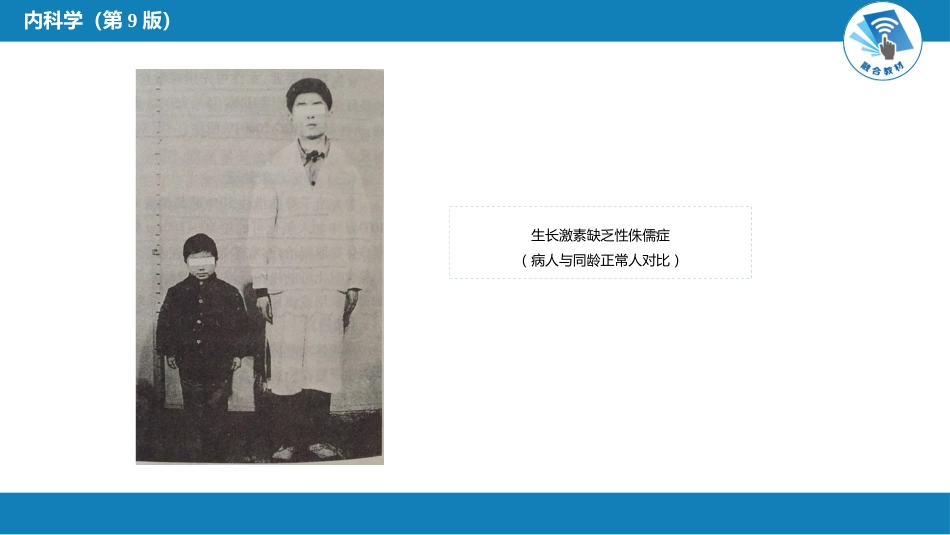 内分泌科：生长激素缺乏性矮小症_第6页