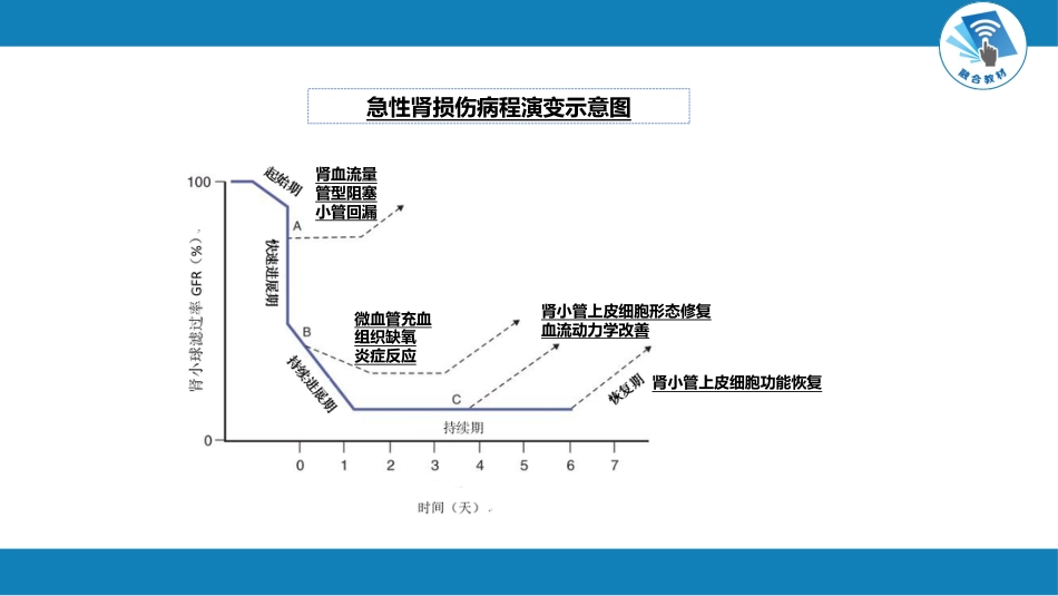 肾内科：急性肾损伤_第10页
