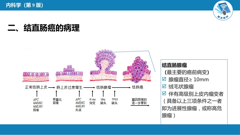 消化内科：结直肠癌_第4页