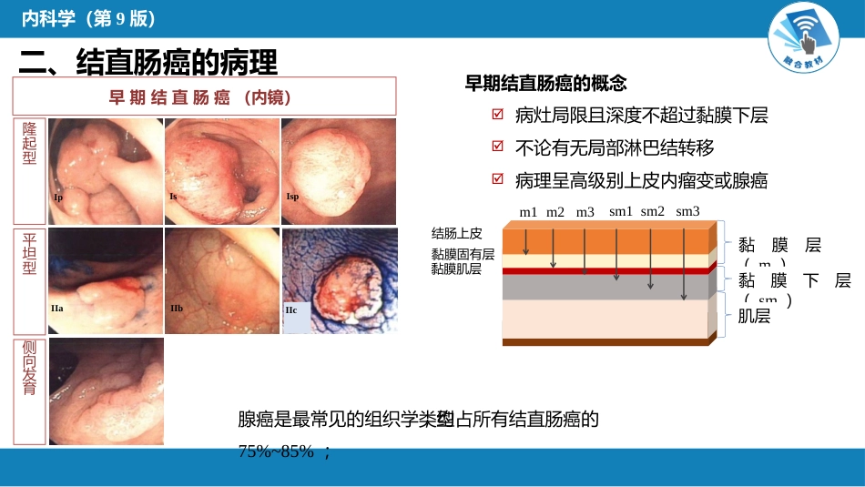 消化内科：结直肠癌_第5页