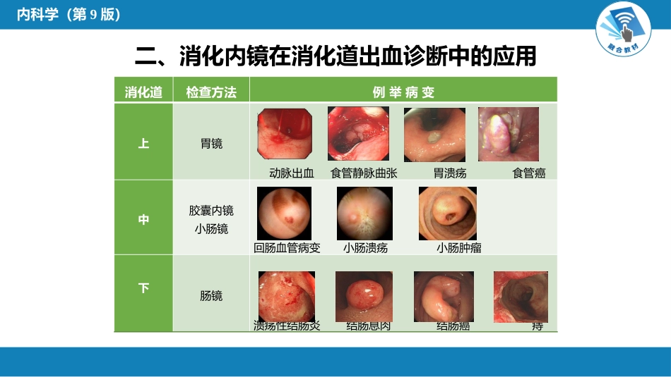 消化内科：消化道出血_第4页