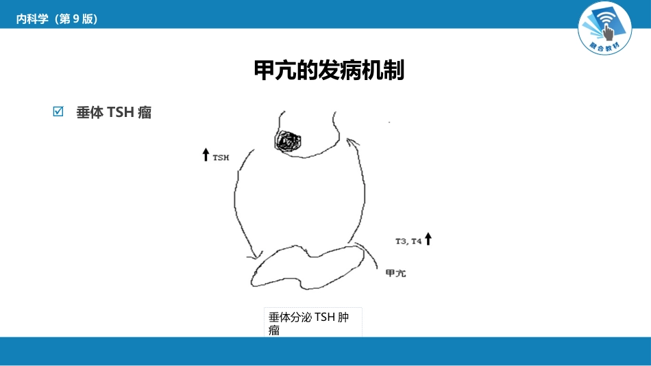 内分泌科：甲状腺功能亢进症_第10页