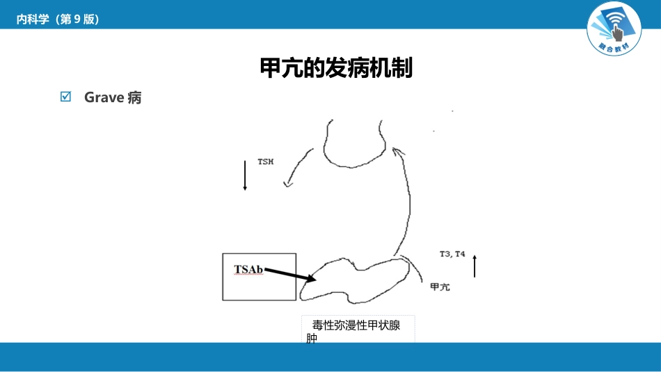 内分泌科：甲状腺功能亢进症_第8页