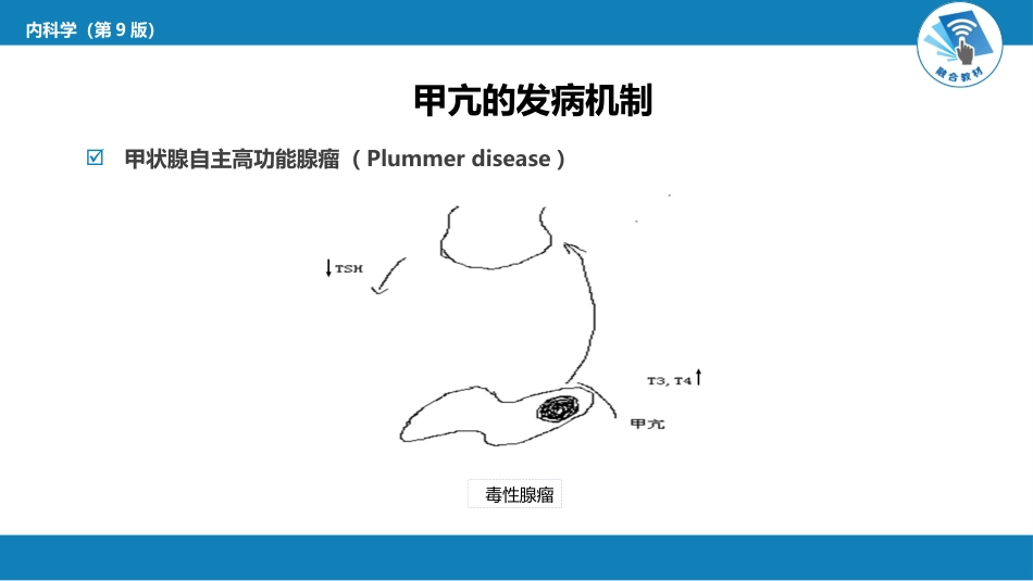 内分泌科：甲状腺功能亢进症_第9页